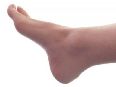 Dealing with Swelling Feet as You Get Older? Learn the Causes and Natural  Treatments - Softstar Blog