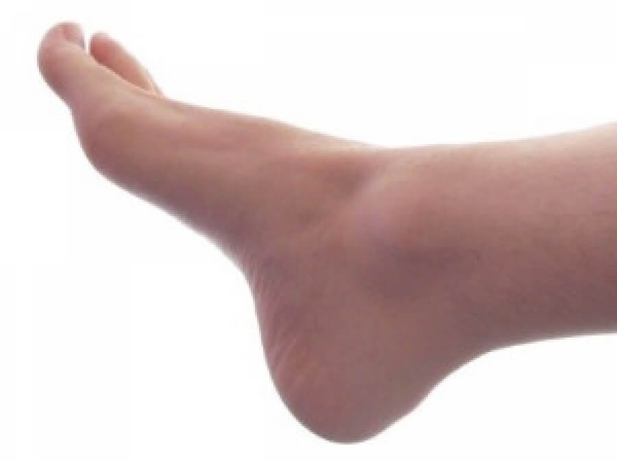 Dealing with Swelling Feet as You Get Older? Learn the Causes and Natural  Treatments - Softstar Blog